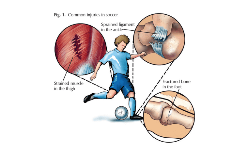 Common Soccer Cleat Injuries